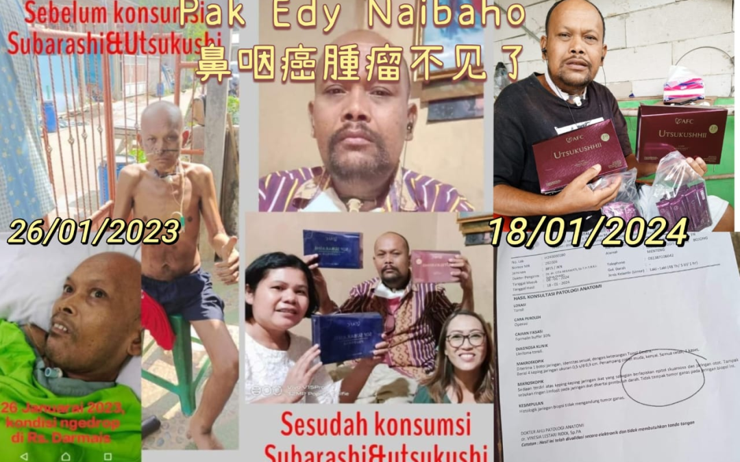 The nasopharyngeal cancer tumor was cured, and AFC gave him a second chance at life.